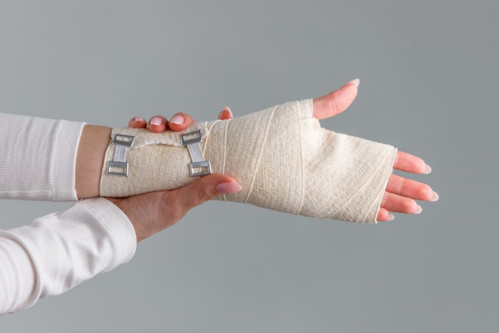 Une femme ayant une fracture à la main