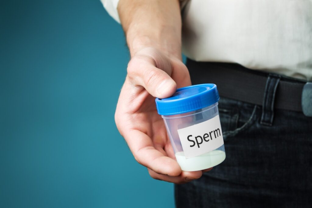 Un homme qui tient un échantillon de spermatozoïde pour un test médical