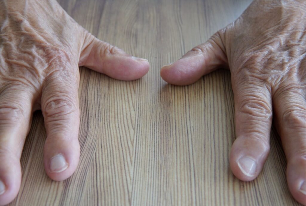 Mains d'une personne âgée