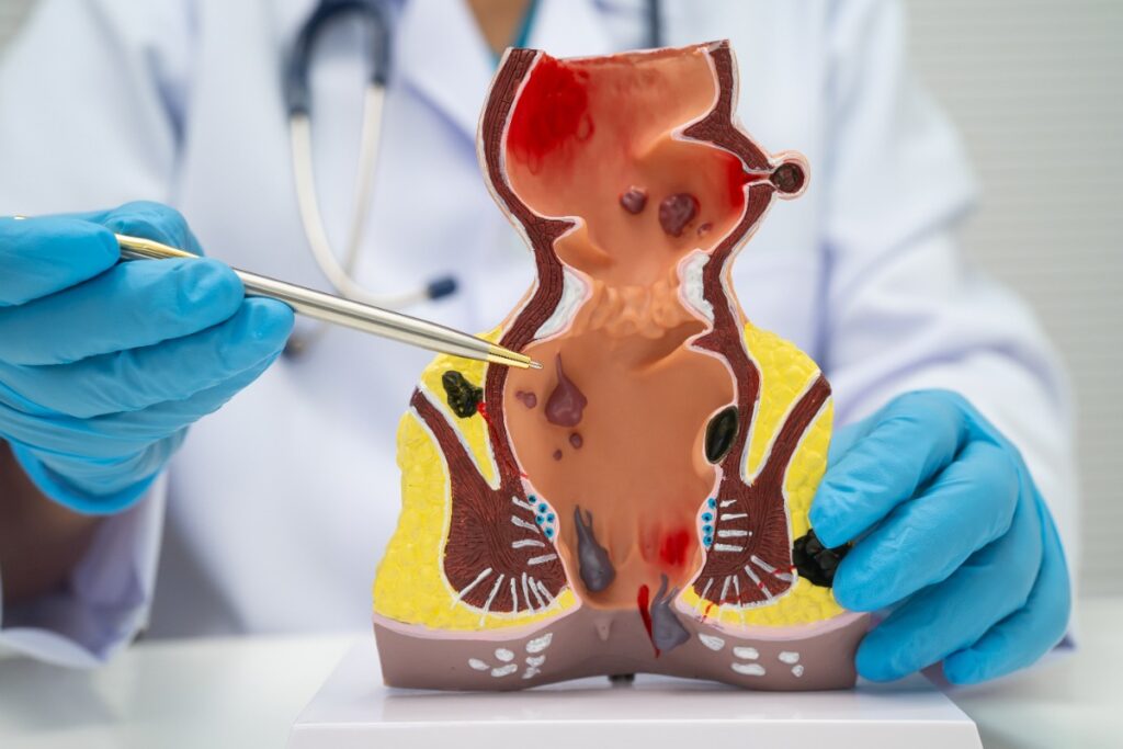 Un médecin faisant un examen de l'anatomie féminine