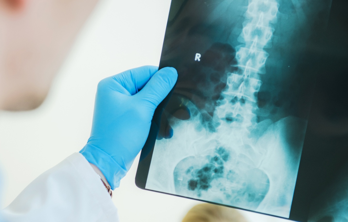 Un médecin qui regarde et examine une radiographie